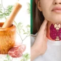 home remedies for thyroid