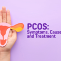 Pcos Symptoms Treatment